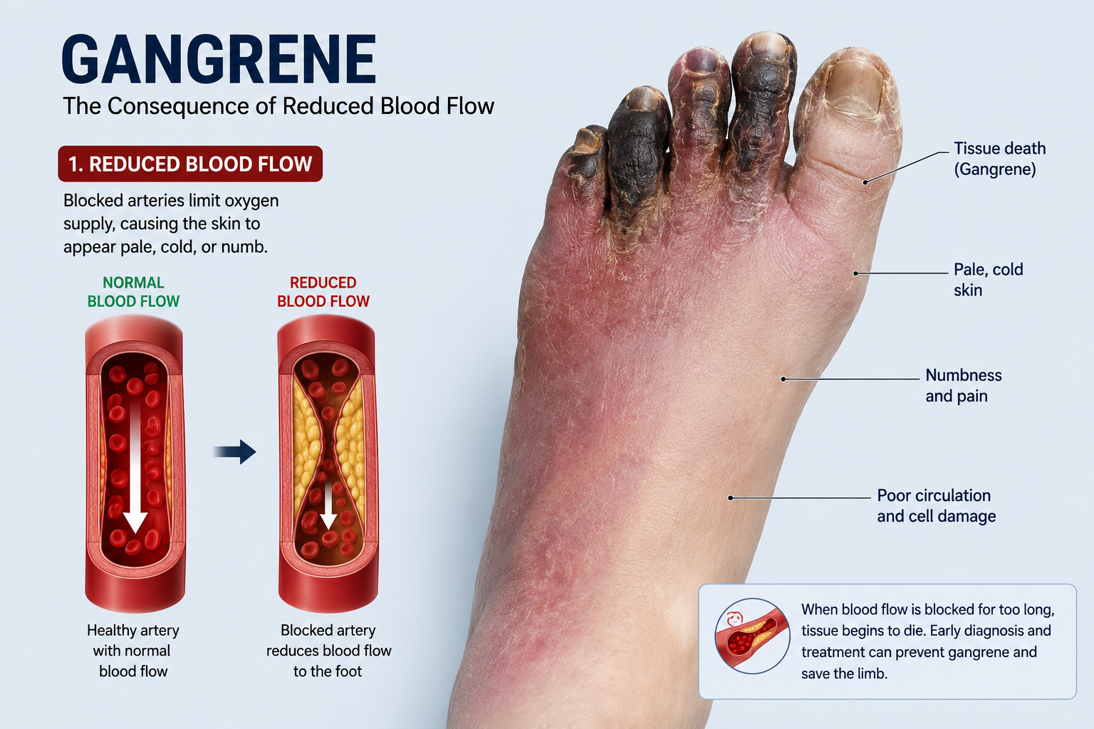 Reduced blood flow